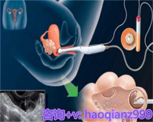 滨医附院供卵承诺不成功退全款,预防宝宝夏天长痱子有妙招