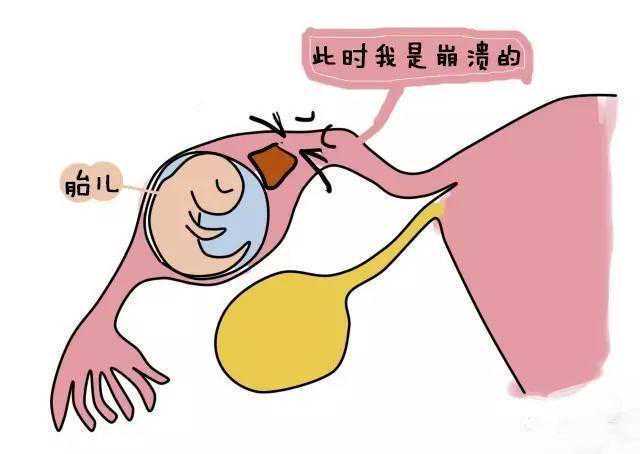 沈阳代怀孕服务：孕期饮食与宝宝健康